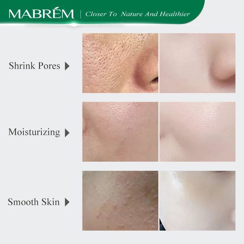 MABREM pore shrinking serum.