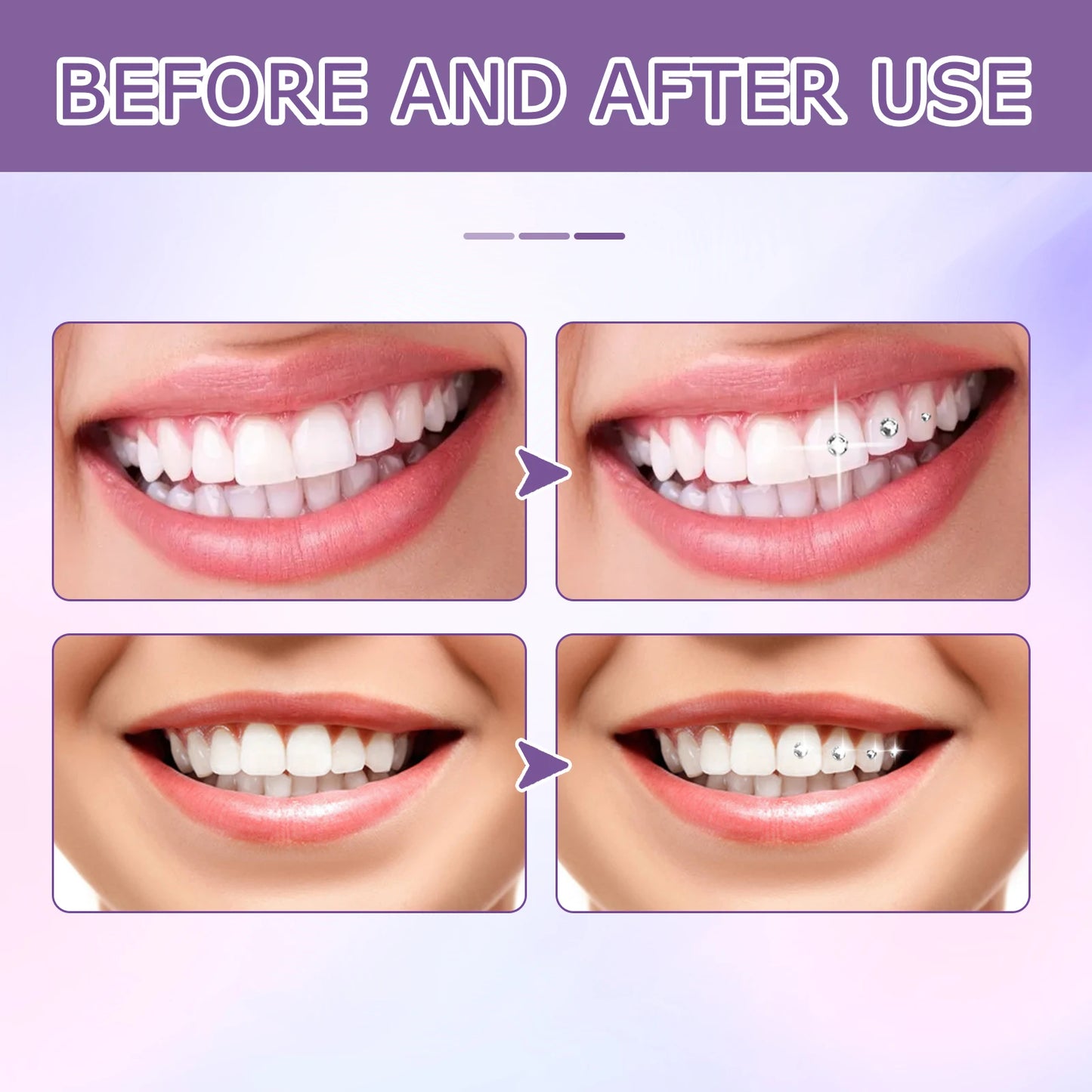EELHOE  Dental Adhesive For Tooth Gems,