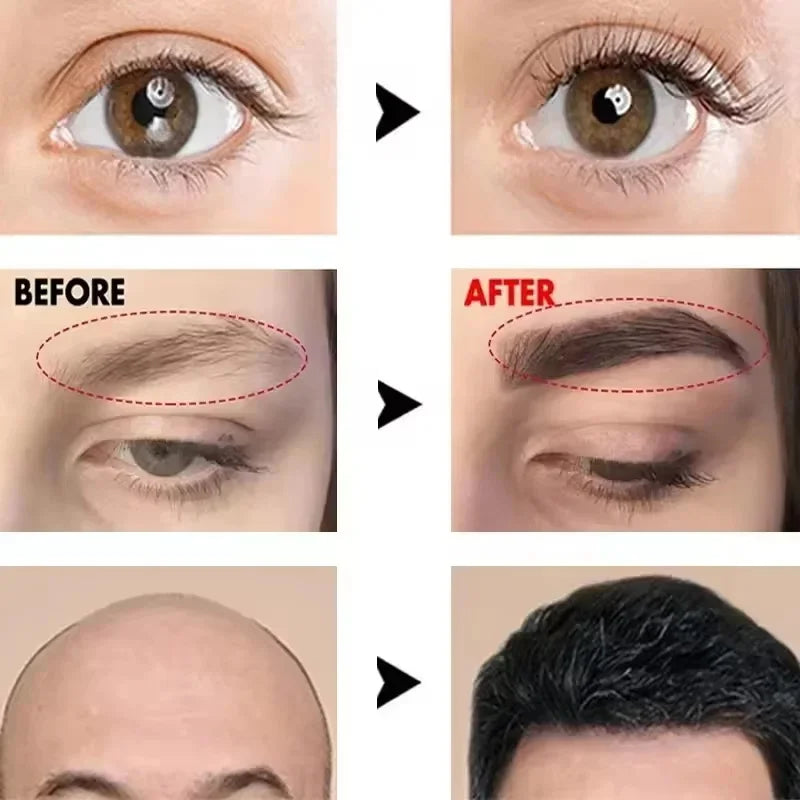 Fast Eyebrow and Eyelash Growth Serums.