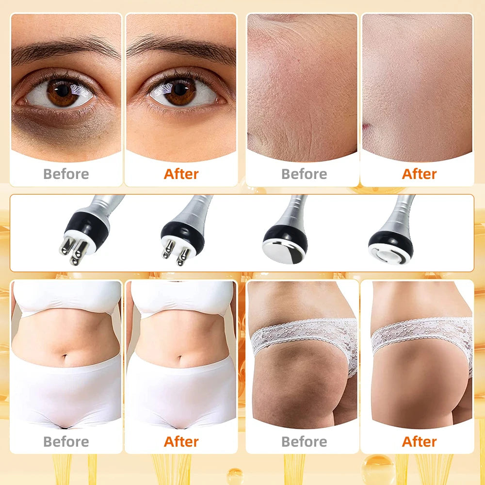 Skin Tightening and  Face Lifting Machine.