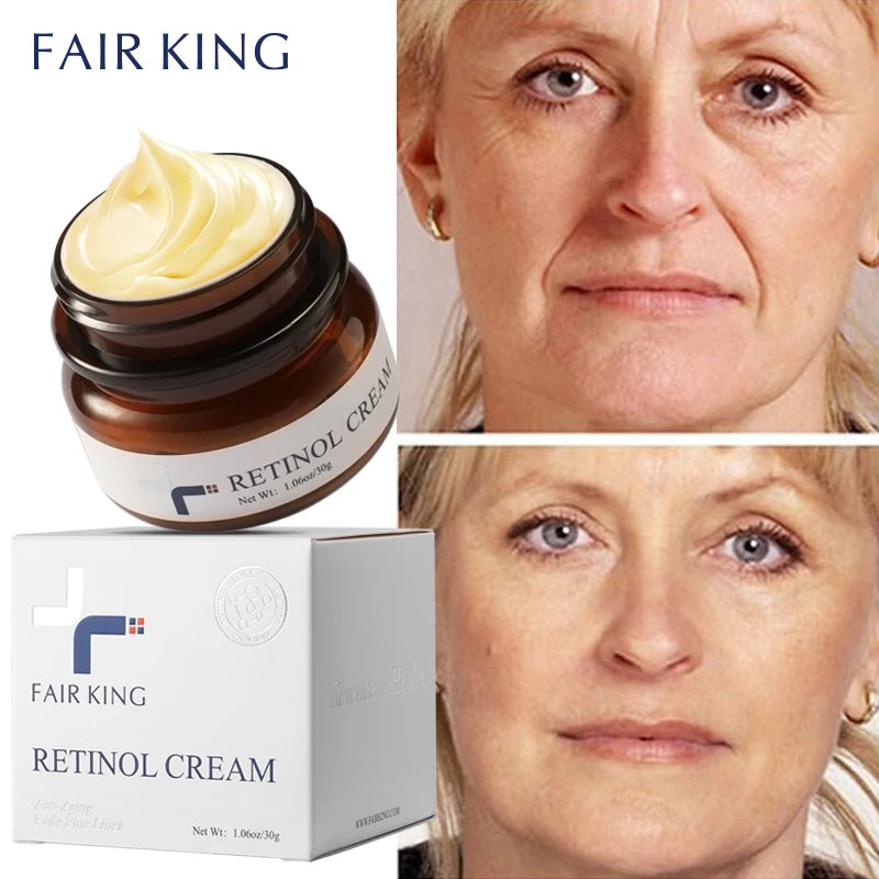 Retinol ,anti-aging, wrinkle lightening, and whitening spots accelerated skin renewal cream.